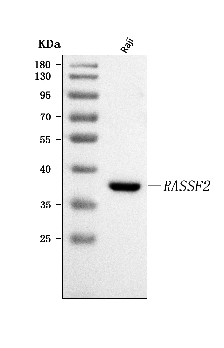  Western blot analysis of RASSF2 using anti-RASSF2 antibody (A04384-1)