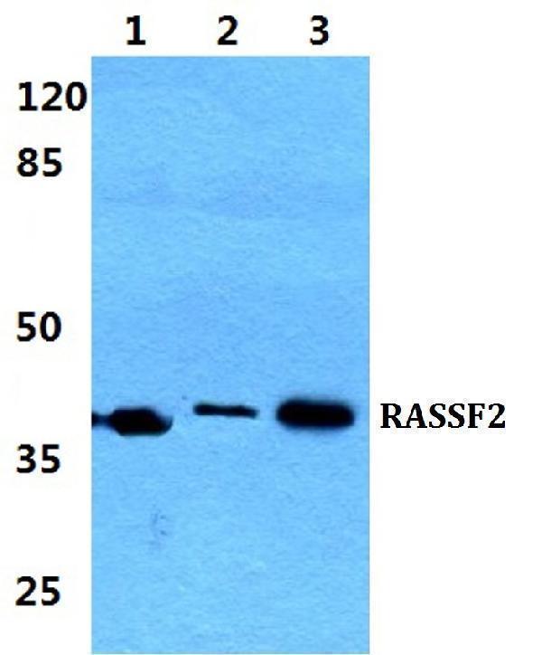 Western blot (WB) analysis of RASSF2 polyclonal antibody at 1:500 dilution
Lane1:Hela cell lysate
Lane2:NIH-3T3 cell lysate
Lane3:H9C2 cell lysate