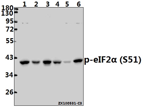 Western blot (WB) analysis of p-eIF2α (S51) pAb at 1:500 dilution
Lane1:Hela whole cell lysate(40ug)
Lane2:MCF-7 whole cell lysate(40ug)
Lane3:The Uterus tissue lysate of Rat(40ug)
Lane4:The Lung tissue lysate of Mouse(40ug)
Lane5:A2780 whole cell lysate(40ug)
Lane6:H1792 whole cell lysate(40ug)
