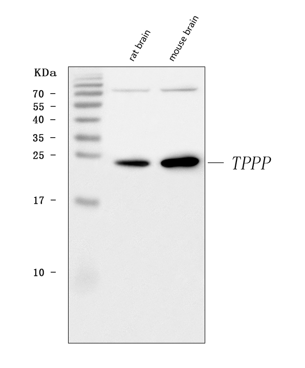  Western blot analysis of TPPP using anti-TPPP antibody (A04389-2)