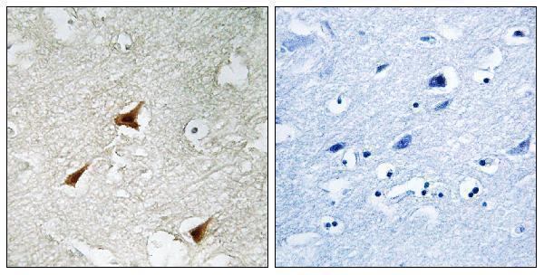 Immunohistochemistry analysis of paraffin-embedded human brain, using p19 INK4d Antibody