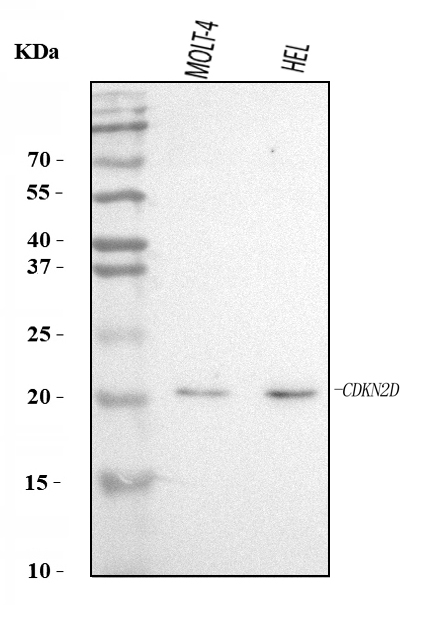  Western blot analysis of P19 INK4d/CDKN2D using anti-P19 INK4d/CDKN2D antibody (A04390-2)