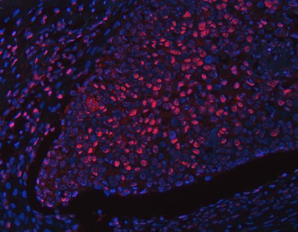 a04392 1 rfx1 primary antibodies if testing 7