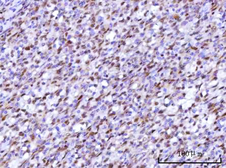  IHC analysis of RFX1 using anti-RFX1 antibody (A04392-1)