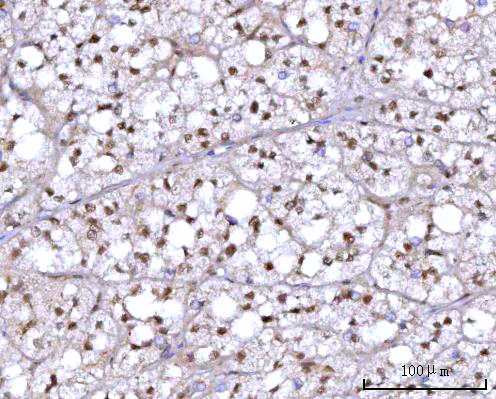  IHC analysis of RFX1 using anti-RFX1 antibody (A04392-1)