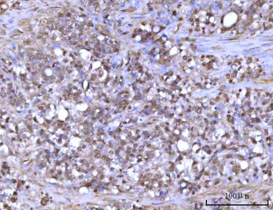 a04392 1 rfx1 primary antibodies ihc testing 4