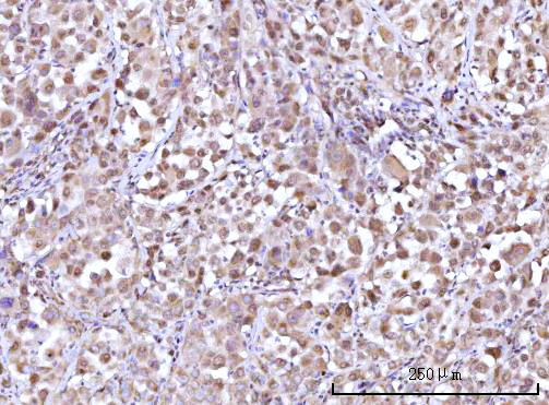 a04392 1 rfx1 primary antibodies ihc testing 5