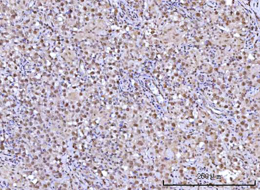 a04392 1 rfx1 primary antibodies ihc testing 6