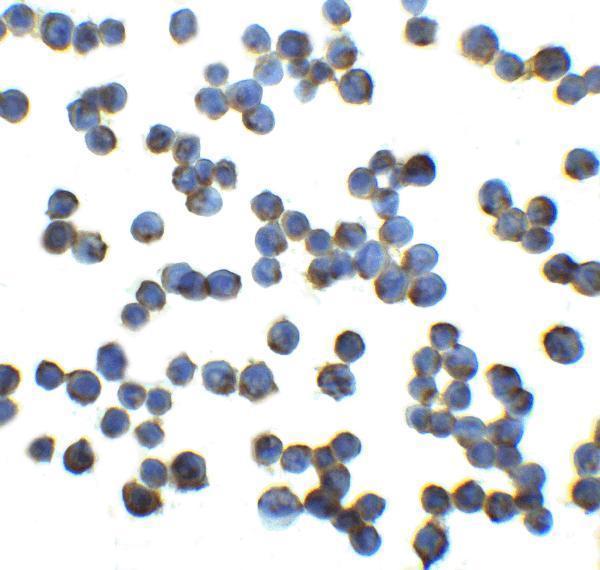 Immunocytochemistry of RFX1 in HeLa cells with RFX1 at 5 μg/mL