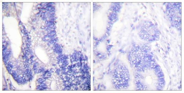 a04393 2 cldn3 primary antibodyes ihc testing 4