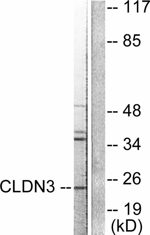a04393 2 cldn3 primary antibodyes wb testing 2