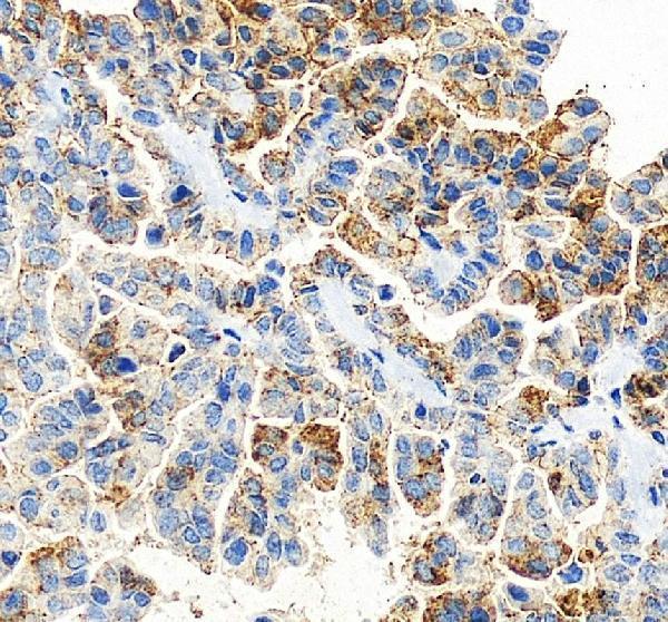 IHC analysis of Claudin 3/CLDN3 using anti-Claudin 3/CLDN3 antibody (A04393-3)