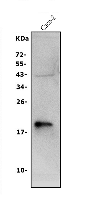  Western blot analysis of Claudin 3/CLDN3 using anti-Claudin 3/CLDN3 antibody (A04393-3)
