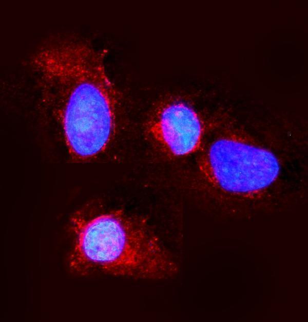  IF analysis of Claudin 3/CLDN3 using anti-Claudin 3/CLDN3 antibody (A04393-4)