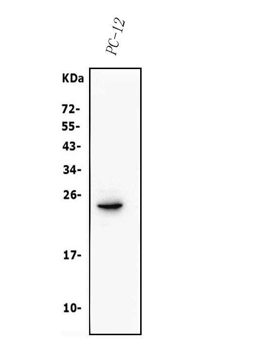  Western blot analysis of Claudin 3/CLDN3 using anti-Claudin 3/CLDN3 antibody (A04393-4)