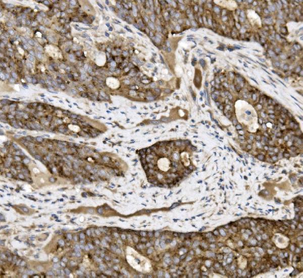 a04393 5 cldn3 primary antibodies ihc testing 3