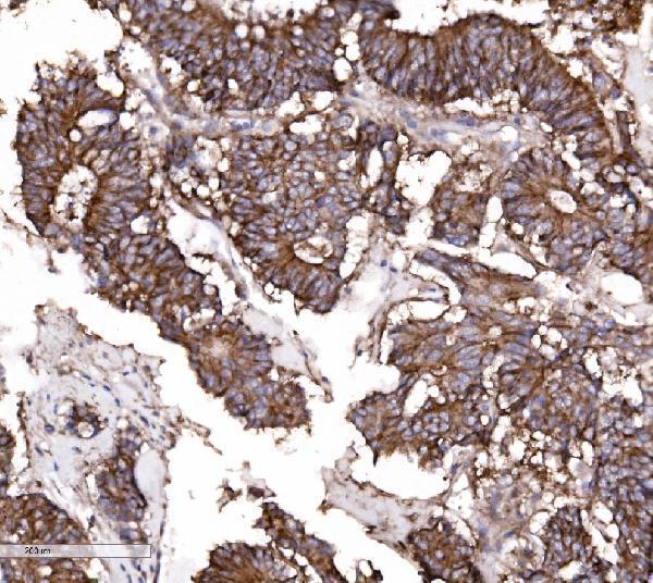 a04393 5 cldn3 primary antibodies ihc testing 5