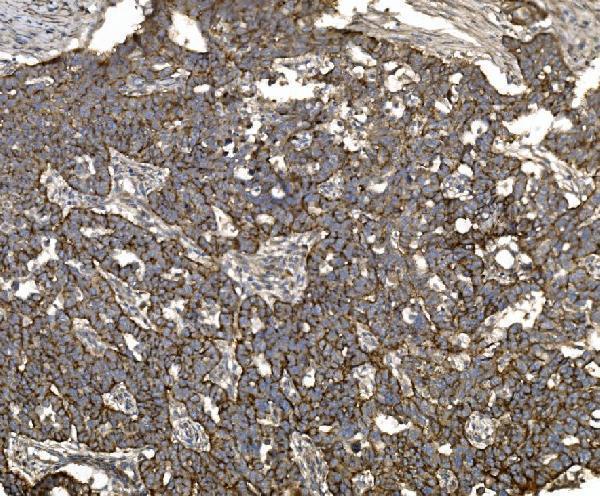 a04393 5 cldn3 primary antibodies ihc testing 6