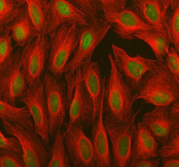 a04395 rbm15 primary antibodies if testing 1