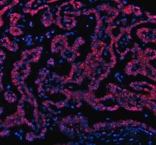 a04395 rbm15 primary antibodies if testing 2