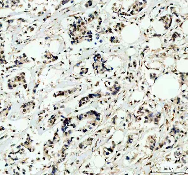 a04395 rbm15 primary antibodies ihc testing 1