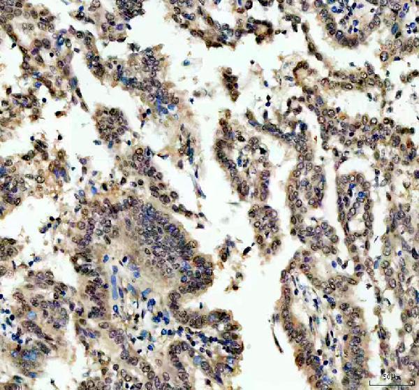 a04395 rbm15 primary antibodies ihc testing 2_1