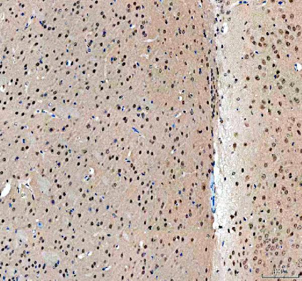 a04395 rbm15 primary antibodies ihc testing 3_1