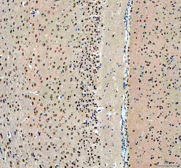 a04395 rbm15 primary antibodies ihc testing 4_1