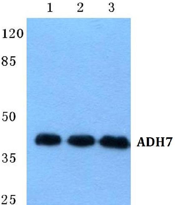 Western blot (WB) analysis of ADH7 polyclonal antibody at 1:500 dilution
Lane1:Hela cell lysate
Lane2:sp2/0 cell lysate
Lane3:PC12 cell lysate