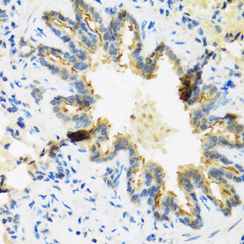 a04398 1 defb4a primary antiboties ihc testing 1