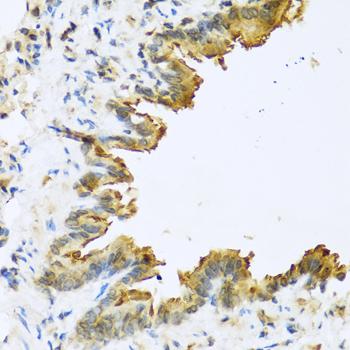 a04398 1 defb4a primary antiboties ihc testing 2