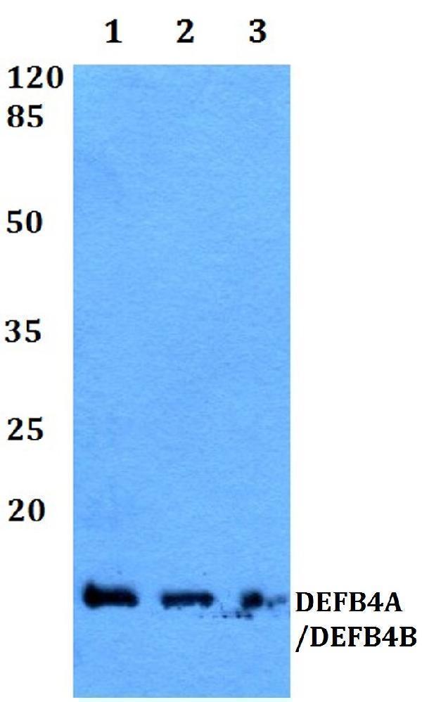 Western blot (WB) analysis of DEFB4 polyclonal antibody at 1:500 dilution
Lane1:HEK293T whole cell lysate
Lane2:Raw264