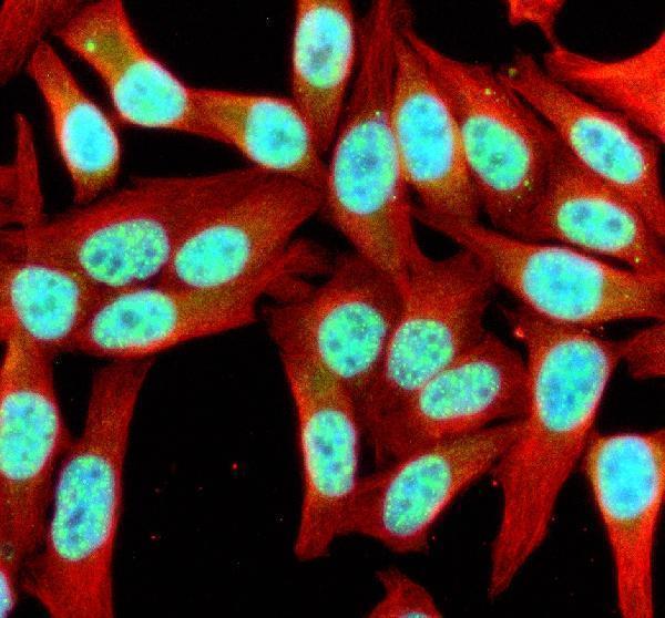 IF analysis of SIK1 using anti-SIK1 antibody (A04399-2) and anti-Beta Tubulin antibody (M01857-3)