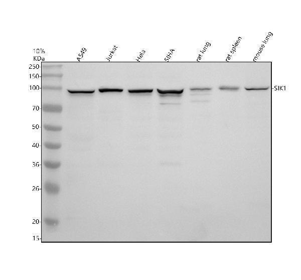 Western blot analysis of SIK1 using anti-SIK1 antibody (A04399-2)