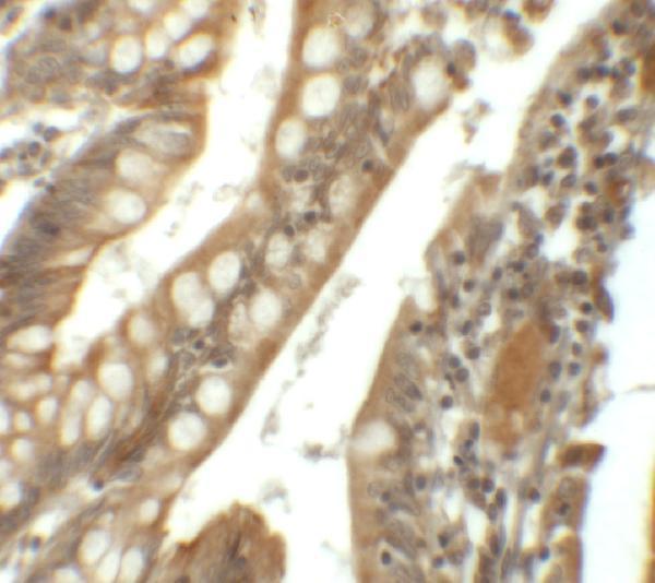 a04399 sik1 primary antibodies ihc testing 2
