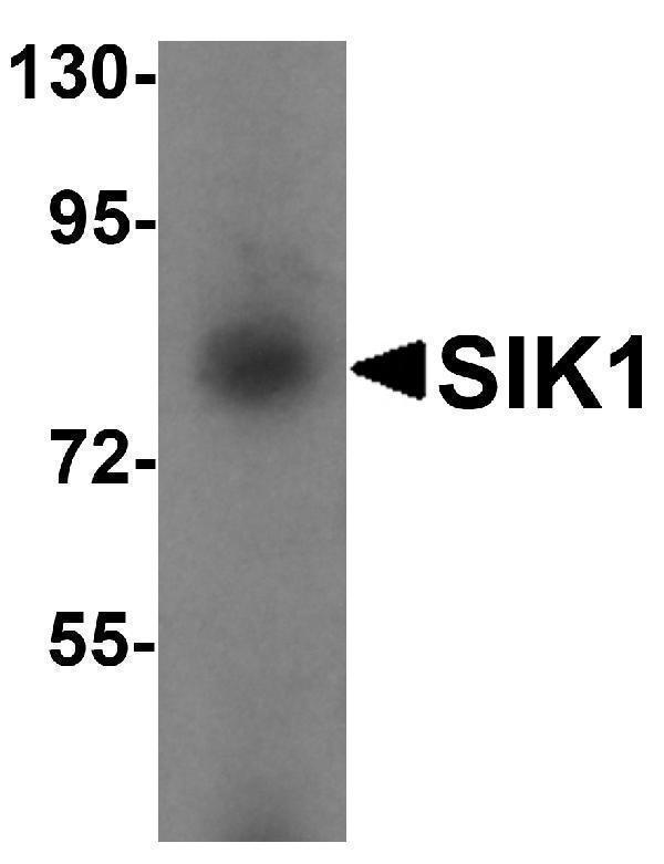 a04399 sik1 primary antibodies wb testing 1