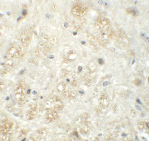 a04402 2 vash1 primary antibodies ihc testing 2