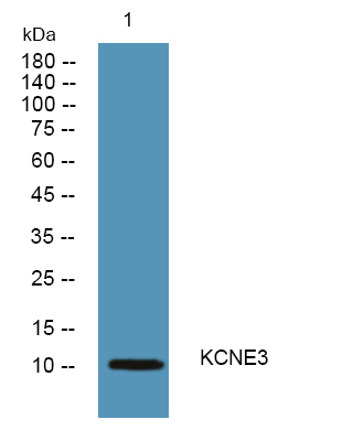 a04404 kcne3 primary antibodies wb testing 1