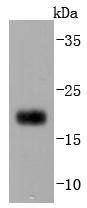 Western blot analysis of CD3D on Jurkat cells lysates using anti-CD3D antibody at 1/1,000 dilution