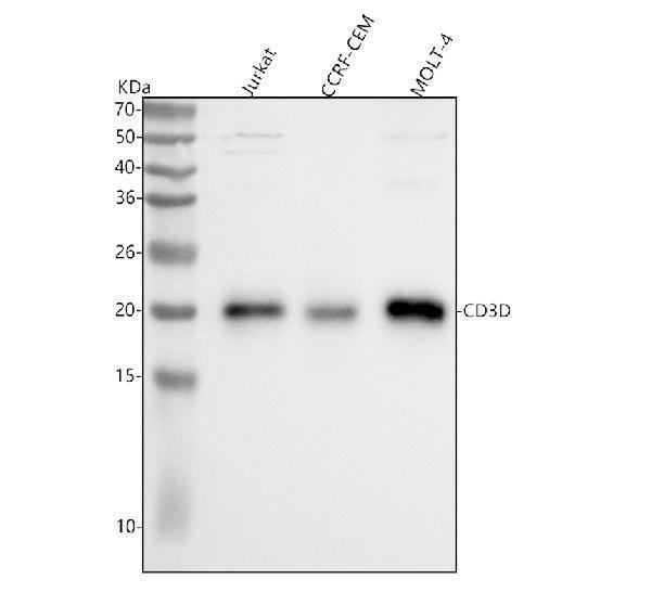  Western blot analysis of CD3D using anti-CD3D antibody (A04405-2)