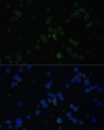 Immunofluorescence analysis of Jurkat cells using CD3D antibody  at dilution of 1:100