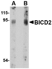 a04406 bicd2 primary antibodies wb testing 1