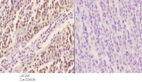 Immunohistochemistry (IHC) analyzes of Oct-2 (H3) pAb in paraffin-embedded human tonsil carcinoma tissue at 1:50