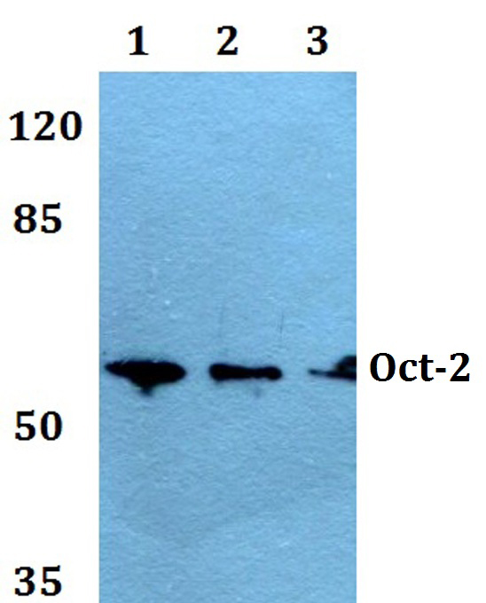 Western blot (WB) analysis of Oct-2 (H3) polyclonal antibody at 1:500 dilution
Lane1:HEK293T whole cell lysate
Lane2:NIH-3T3 whole cell lysate
Lane3:H9C2 whole cell lysate