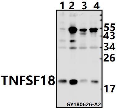 Western blot (WB) analysis of TNFSF18 pAb at 1:1000 dilution
Lane1:SK-OVCAR3 whole cell lysate(40ug)
Lane2:HEK293T whole cell lysate(40ug)
Lane3:The Testis tissue lysate of Mouse(40ug)
Lane4:The Testis tissue lysate of Rat(40ug)