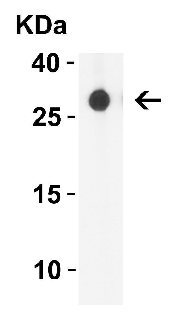 WB Validation  in Human Pancreas 
Loading: 10 μg of lysate 
Antibodies:  GITRL, A04408, 4 μg/mL , 1 h incubation at RT in 5% NFDM/TBST