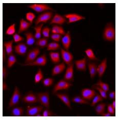 Immunofluorescent analysis of COCH staining in HeLa cells