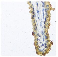 Immunohistochemical analysis of COCH staining in human prostate formalin fixed paraffin embedded tissue section