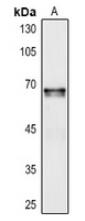 Western blot analysis of COCH expression in HEK293T (A) whole cell lysates