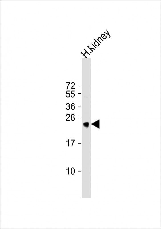 Anti-MSRA Antibody (N-term) at 1:1000 dilution + human kidney lysate Lysates/proteins at 20 microg per lane. Secondary Goat Anti-Rabbit IgG, (H+L), Peroxidase conjugated at 1/10000 dilution. Predicted band size : 26 kDa Blocking/Dilution buffer: 5% NFDM/TBST.